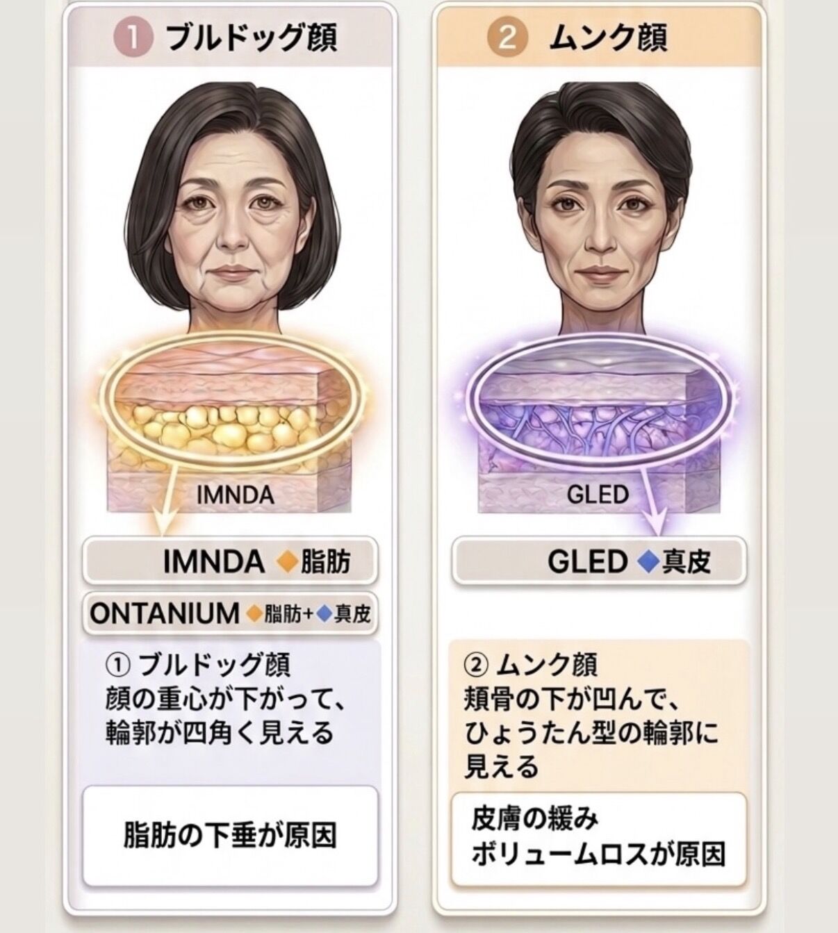 【あなたはどっち？】老け顔の原因別リフトケア選び方